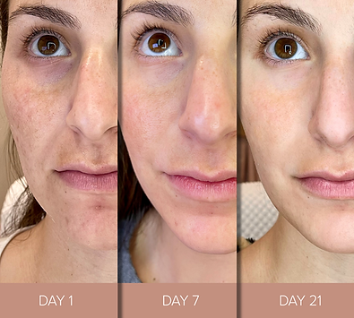 Collagen Elixir |Isagenix